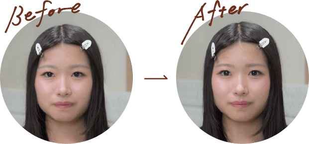 Before → After